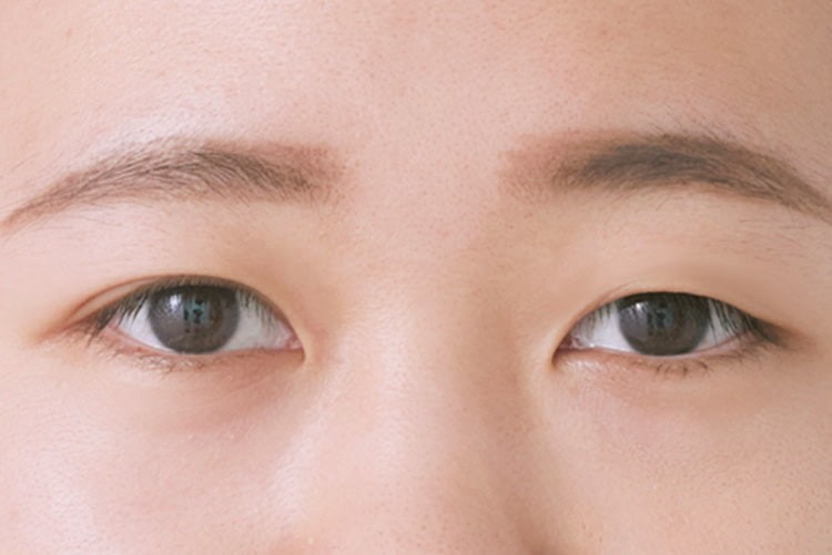 二重幅の左右差の整え方って 皮膜式アイプチを使った 奥二重 の作り方 Ray Web