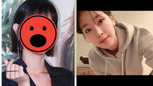 24歲名模整形被發現小眼割成超大電眼 Nownews 今日新聞 Line Today