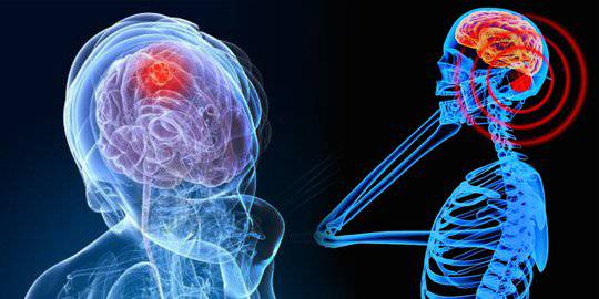 ilustrasi kanker otak karean radiasi ponsel. ©2016 Merdeka.com