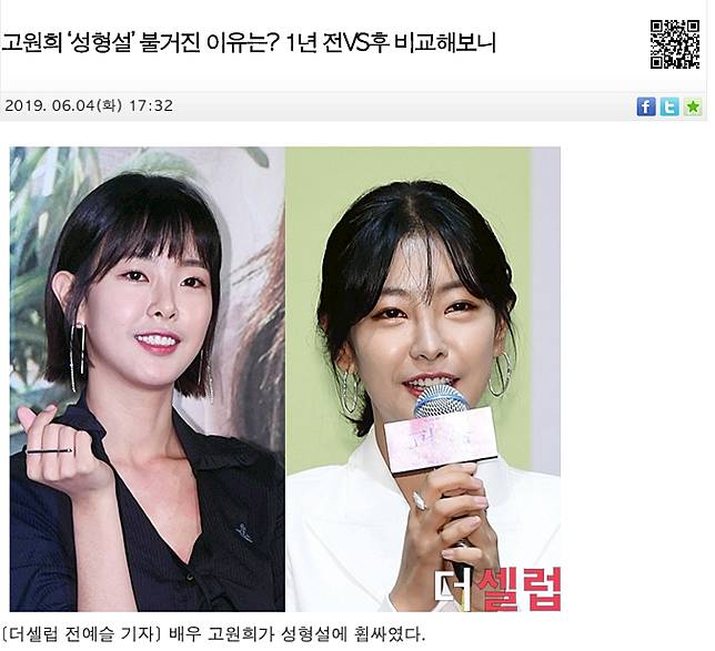 24歲名模整形被發現小眼割成超大電眼 Nownews 今日新聞 Line Today