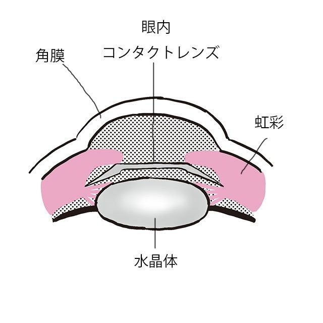 目の疲れ対策 エクササイズや目薬 目元温め 正しいセルフケアで健康な目をキープ 美的news