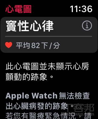 Apple Watch 心電圖實測
