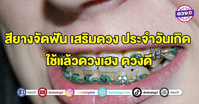 ฟันเหล็กเด็กแนว! สียางจัดฟัน เสริมดวง ประจำวันเกิด ใช้แล้วดวงเฮง ดวงดี.. |  ดวง D | Line Today