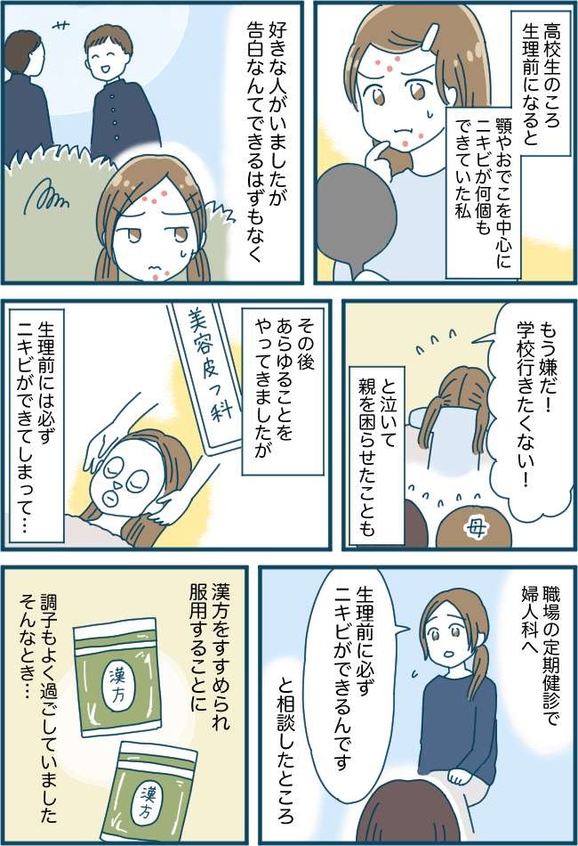 もう嫌 どうしたらいいの 生理前のニキビ 10年の闘いの末 改善のきっかけとなったのは ベビーカレンダー