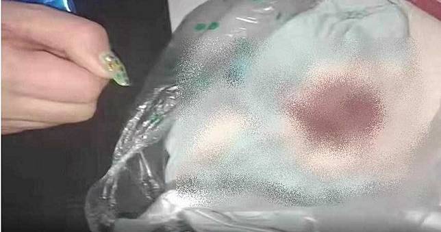 女老師狠踹！7歲男童「下體被踢爆」撕裂2cm超腫　血水一直流