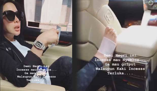  Kaki Syahrini Tertimpa Lemari, Reino Barack Langsung Bawa ke Dokter Naik Jet Pribadi
