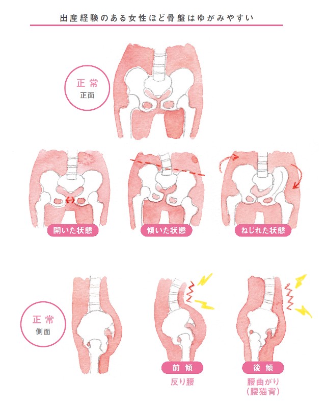 変な姿勢が クセ になってませんか 体のゆがみ 3つの要因