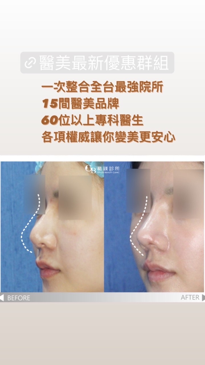 海外醫美交流群（最新醫美資訊）