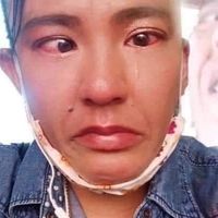 ดันแอคไอจี