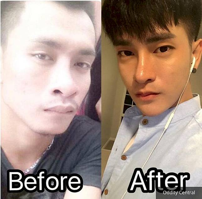 Penampilan Ratchadapong Prasit sebelum dan sesudah