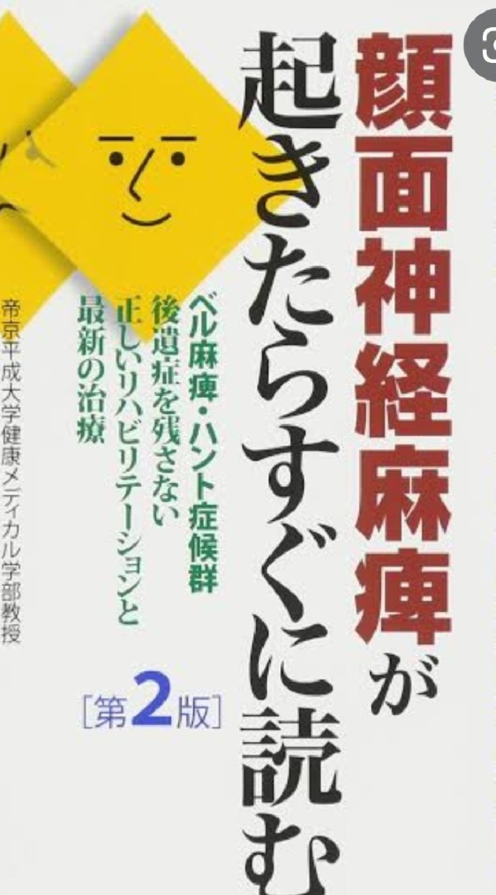 顔面麻痺　ベル麻痺　ハント症候群
