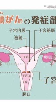 女性疾病婦科困擾肌瘤，巧囊，肌腺，不孕等等討論區