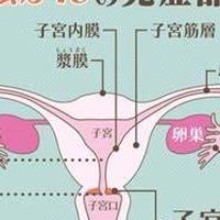 女性疾病婦科困擾肌瘤，巧囊，肌腺，不孕等等討論區