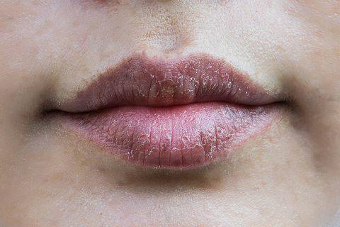 從 唇色 看身體狀況原來這麼準 唇偏紫紅色代表熬夜 愛喝酒 嘴唇蒼白連這件事都有關 Elle Line Today