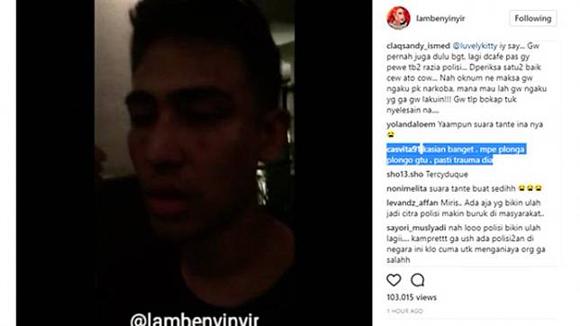 Video Anak Jeremy Thomas dengan Wajah Tampak Memar Jadi Viral