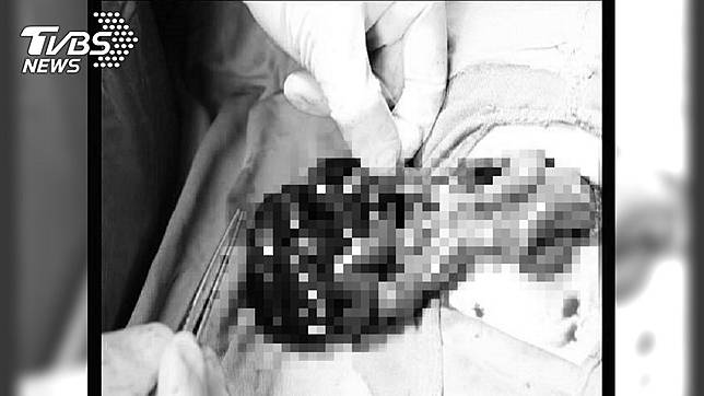 圖／臉書「來講兒科急診的543-吳昌騰醫師」授權使用