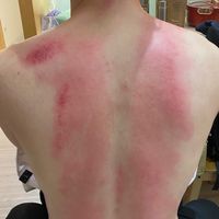 艾夏美學-行動保健師