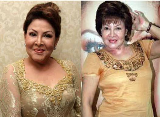 Transformasi penampilan Mpok Atiek ()   Artikel ini telah tayang di Tribunstyle.com dengan judul Deretan Seleb Ini Blak-blakan Ngaku Pernah Operasi Plastik, Lihat Perbedaan Before & After-nya!, http://style.tribunnews.com/2018/04/15/deretan-seleb-ini-blak-blakan-ngaku-pernah-operasi-plastik-lihat-perbedaan-before-after-nya?page=all&_ga=2.85188829.51697449.1523716117-1901692863.1521611343. Penulis: Delta Lidina Putri	 Editor: Delta Lidina Putri