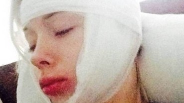 烏克蘭「人類芭比」Valeria Lukyanova在住家附近慘遭致命攻擊！