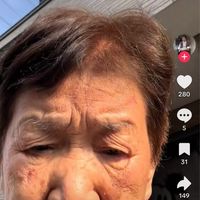 平和民🕊️