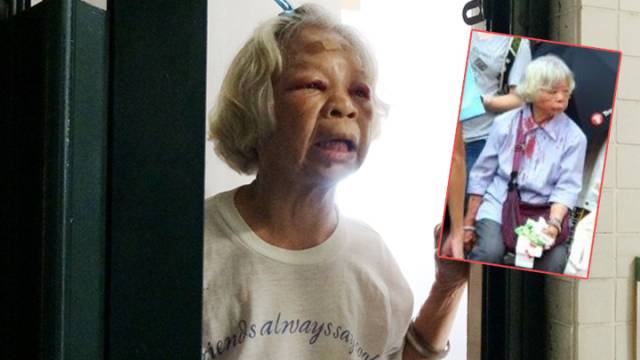 掃帚扑婆婆 雙眼紅腫如雞蛋白蘭花婆婆 告到佢終身監禁 蘋果日報 Line Today