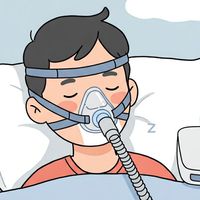 睡眠呼吸中止與呼吸器