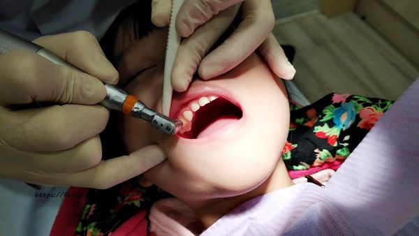 【新莊牙醫】艾旎牙醫診所 #牙醫推薦 #洗牙 (15).jpg