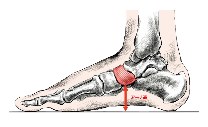 甲高・幅広、外反母趾…。日本人の「足」に関する4つの勘違い（Tarzan）