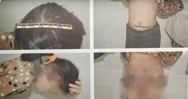 單親媽「復合初戀」！8歲女兒遭同居人「木弓、電線」施暴