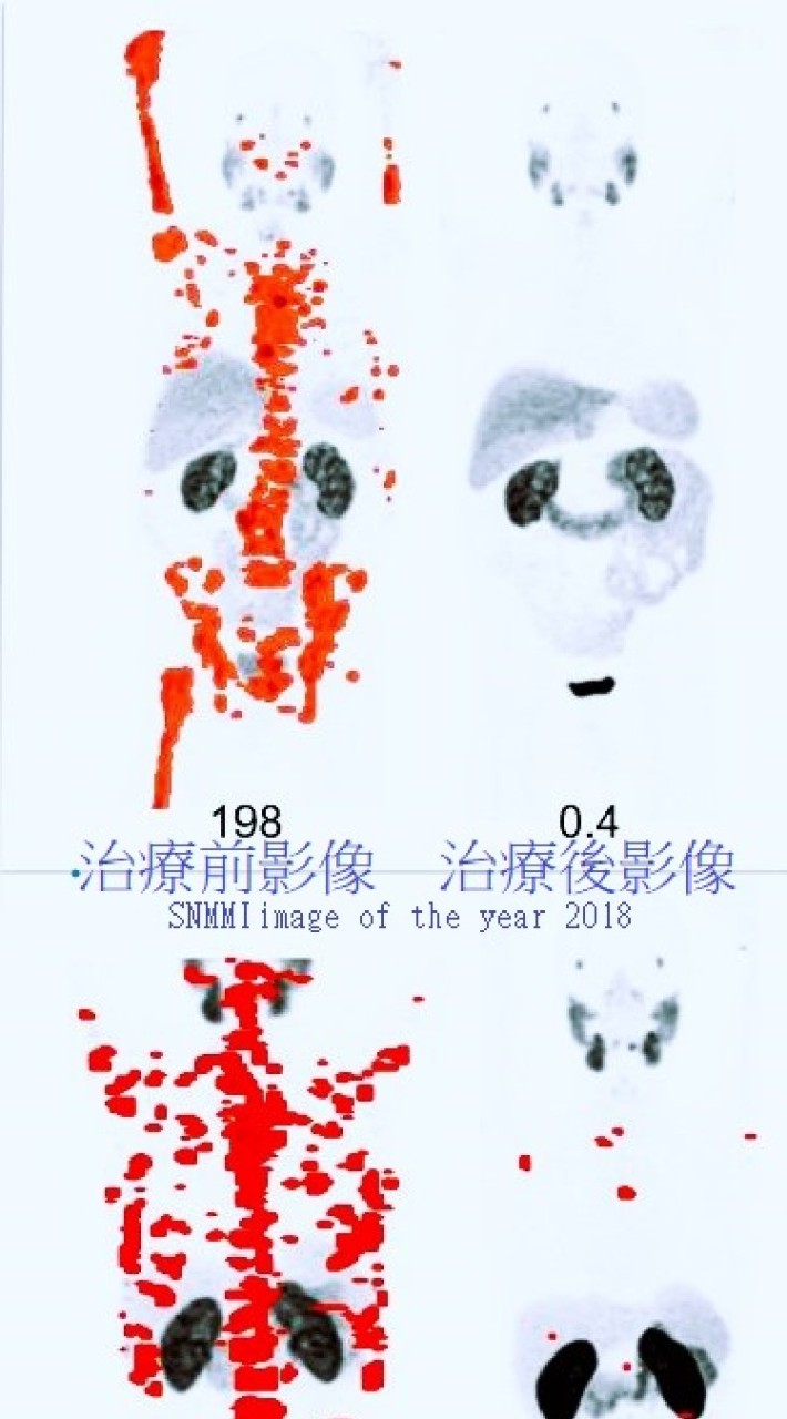 核醫診療標靶治療之友
