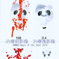 核醫診療標靶治療之友