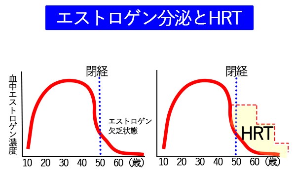 更年期障害を改善するホルモン補充療法 Hrt とは