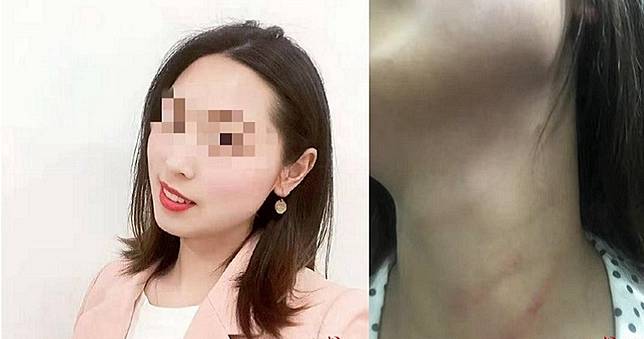 女老師遭夫家暴「打掉牙齒」…下秒墜樓身亡！警自殺結案惹怒家屬