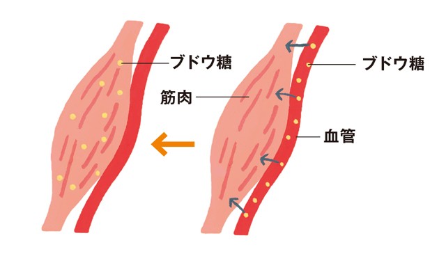 ご存じですか 糖尿病を引き起こす 霜降り筋肉 と 脂肪肝