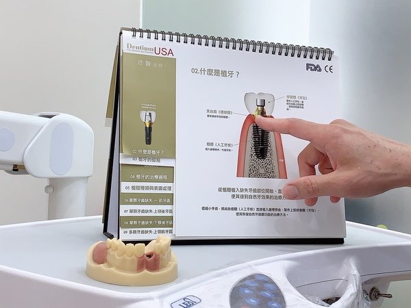 「台中植牙」太平牙醫推薦，全家牙齒守護最佳首選-台中市北屯區星星牙醫診所直擊分享