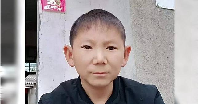 6歲被石頭砸中頭　他腦垂體受損終身「娃娃臉」！