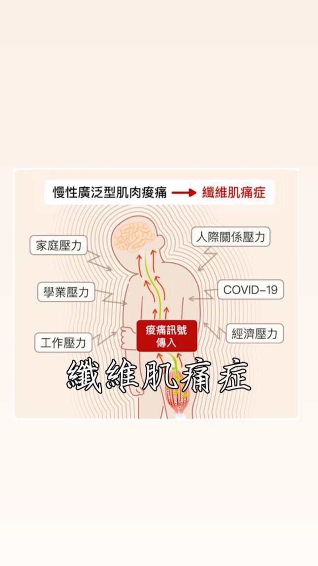 ❤️‍🩹纖維肌痛症-心靈診療室-靠北群組
