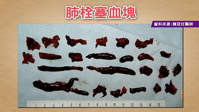 圖/TVBS提供