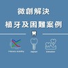 精奈創解決植牙困難問題
