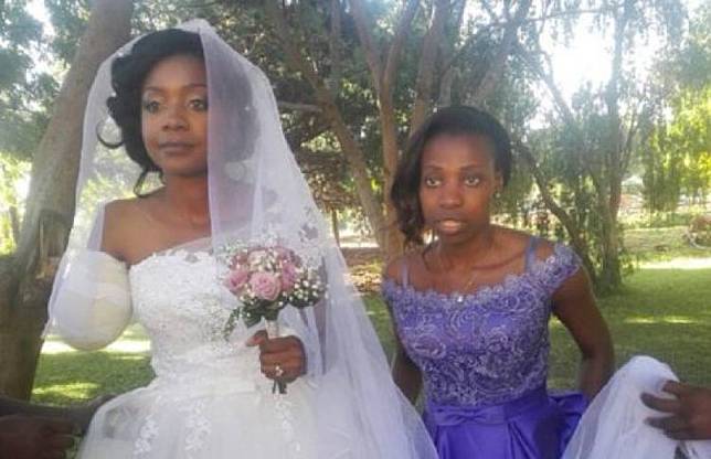 Jelang hari pernikahannya, tangan wanita ini putus digigit buaya