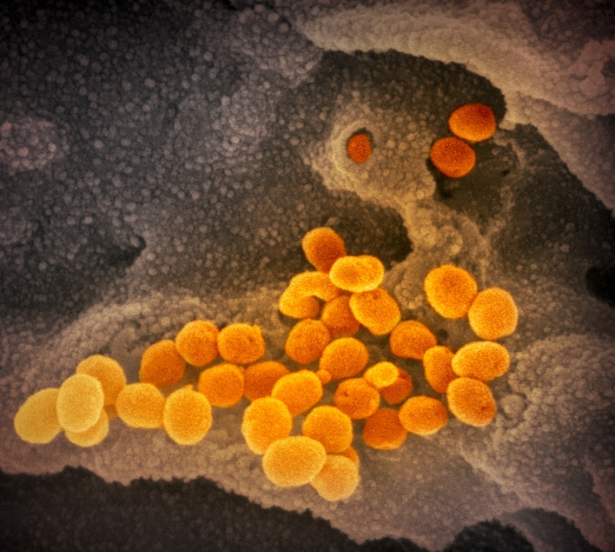 武漢肺炎病毒到底長什麼樣子？這就是惡名昭彰的「COVID-19」真面目