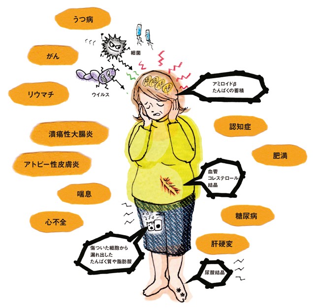 知っておいて 認知症にも深く関わる 慢性炎症 の基礎知識