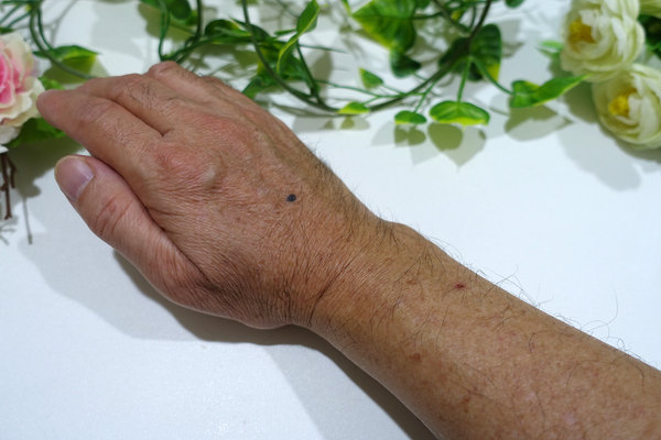 舒利渼SureMed超薄型傷口隱形貼，傷口怕碰水?傷口怕留疤?舒利渼人工皮OK蹦防水、透氣、很薄、服貼，最長可貼5天洗澡、游泳都OK 