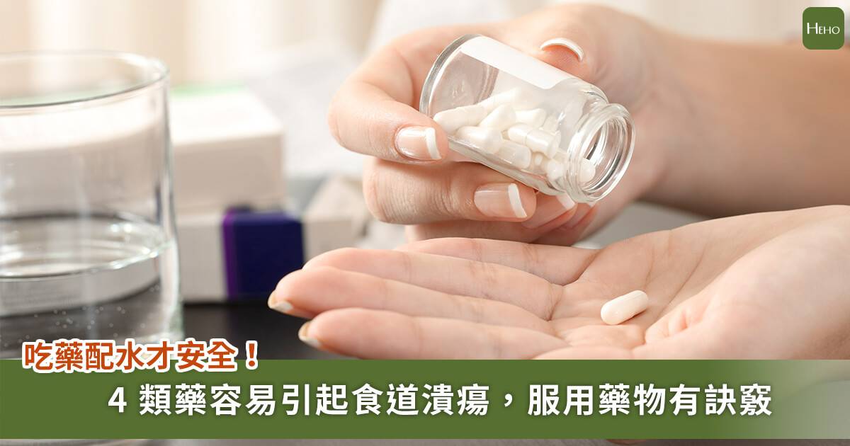 吃藥不配水藥丸卡食道 醫師提醒 4 種藥物容易造成食道發炎 潰瘍 Heho健康 Line Today