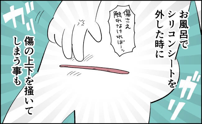 怖い 帝王切開後につらかったこと んぎぃちゃんカレンダー140 ベビーカレンダー