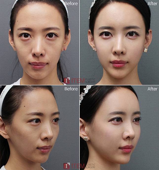 Item Plastic Surgery