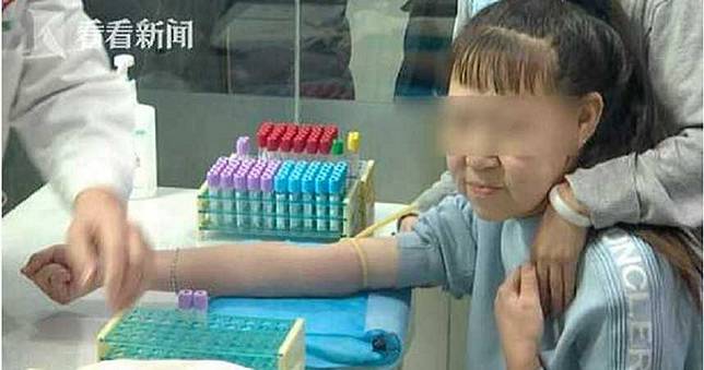 15歲青春少女長60歲老臉　滿臉皺褶、皮膚下垂…這輩子不敢拍照