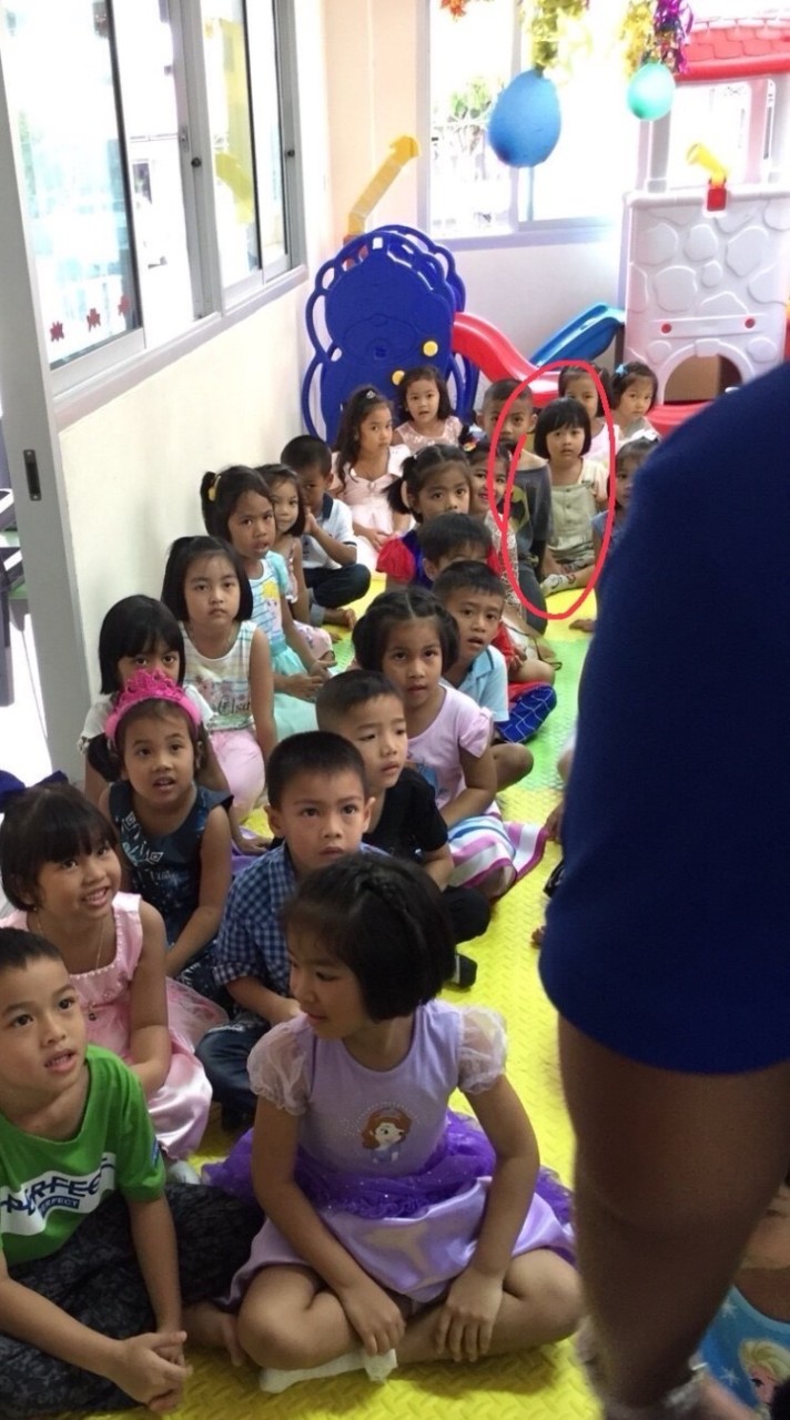 บุคคลติดเชื้อ ออทิสติก  ปญอ  เก   ซิกม่า            ไบโพล่า