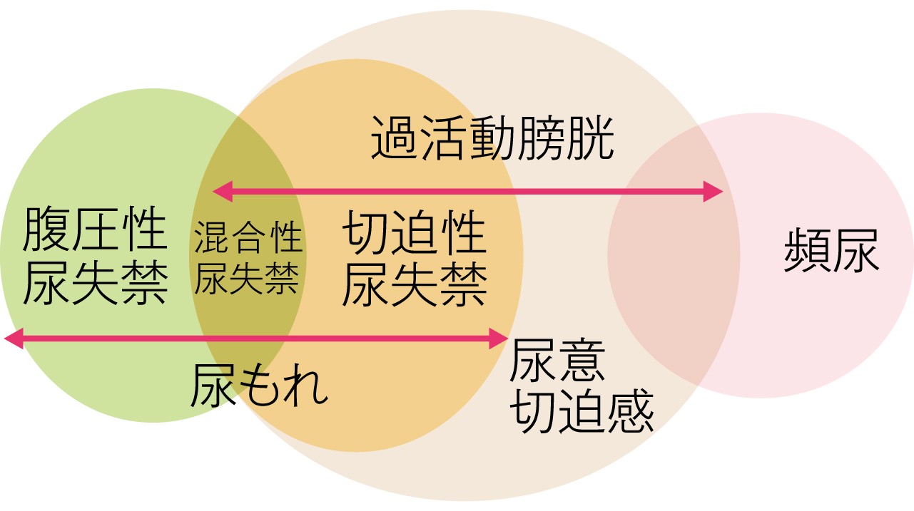 尿もれ・尿失禁 意外に多い女性の悩みを解消する/主婦の友社/中田真木