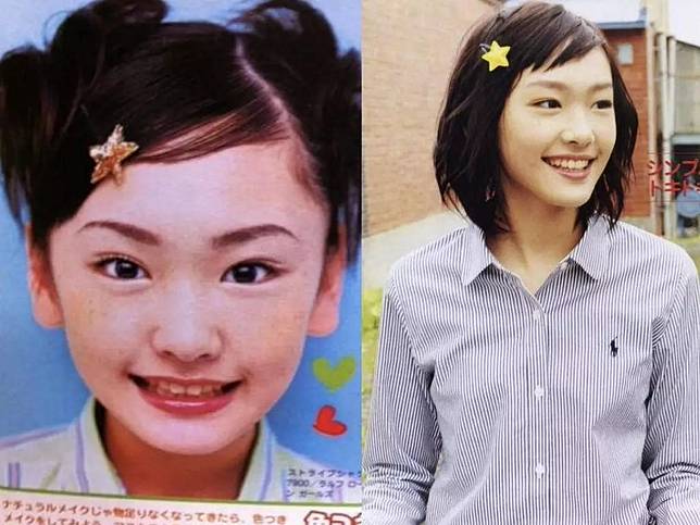 偷偷整容的等級 新垣結衣變身國民老婆前長這樣 日本集合 Line Today